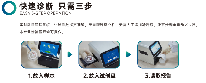 SD1快速诊断只需三步