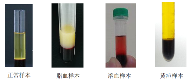 揪出“元凶”！溶血、脂血、药物对生化检验结果的干扰及解决方法